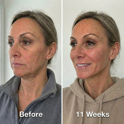 Sculpy™ Face Wrap
